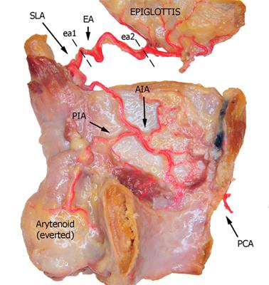 Anatomical Cadaver Study of Endolaryngeal Vascularization: Focus on the Glottis, Supraglottis, and Subglottis From the Transoral Microsurgical Point of View